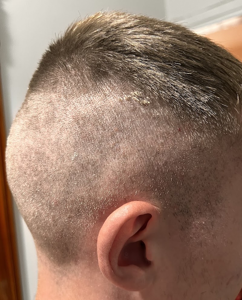 Open hairclub